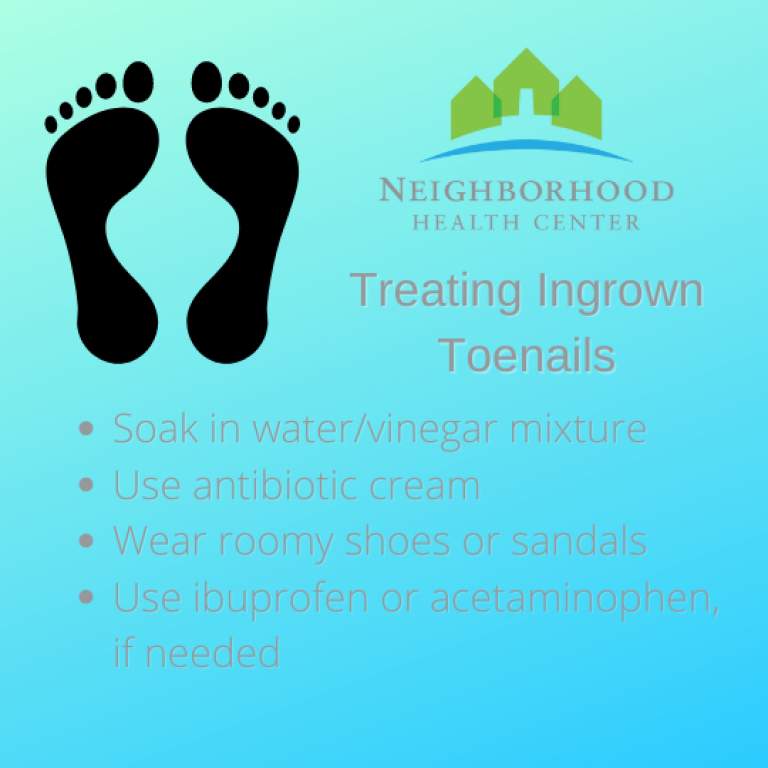 What to do about an Ingrown Toenail